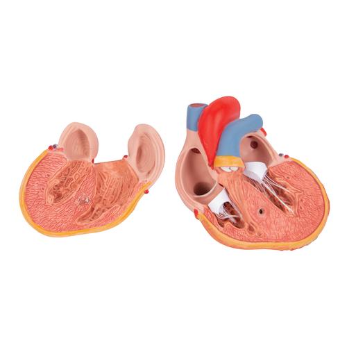 Corazón clásico con hipertrofia ventricular izquierda (HVI), de 2 piezas - 3B Smart Anatomy, 1000261 [G04], Modelos de Corazón