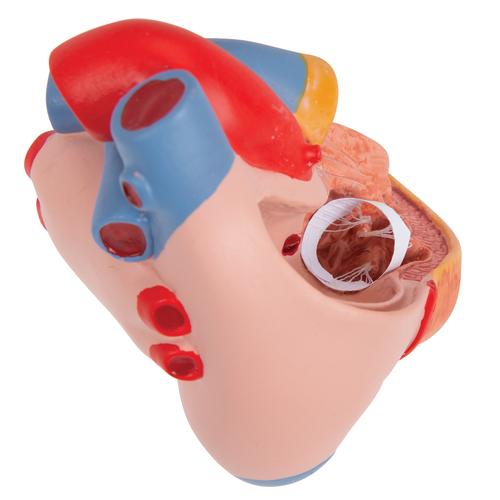 Coração clássico com hipertrofia ventricular esquerda, 2 partes, 1000261 [G04], Modelo de coração e circulação