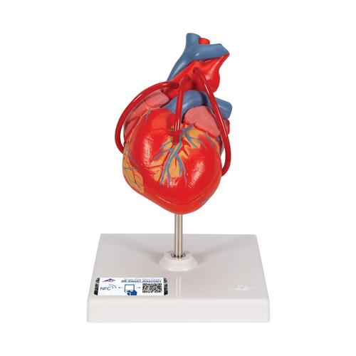 Cœur classique avec pontage, en 2 parties - 3B Smart Anatomy, 1017837 [G05], Modèles cœur et circulation