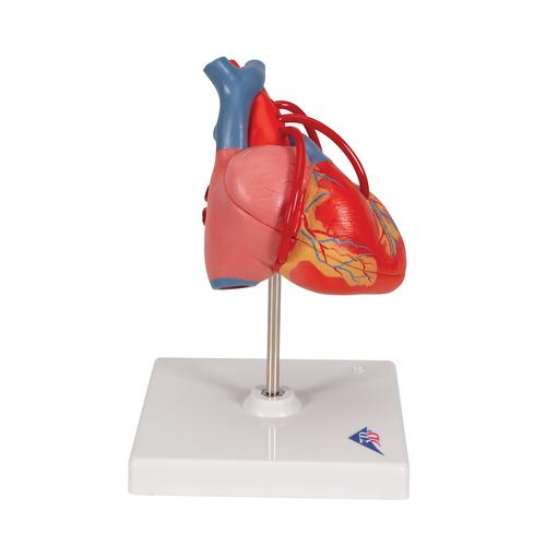 Classic Human Heart Model with Bypass, 2 part - 3B Smart Anatomy, 1017837 [G05], Human Heart Models
