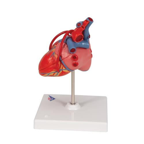 관상동맥 우회술 심장 모형 (2파트) Classic Human Heart Model with Bypass, 2 part - 3B Smart Anatomy, 1017837 [G05], 심장 및 순환기 모형