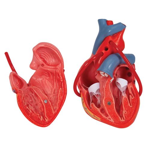 Классическая модель сердца с шунтом, 2 части - 3B Smart Anatomy, 1017837 [G05], Модели сердца и сосудистой системы