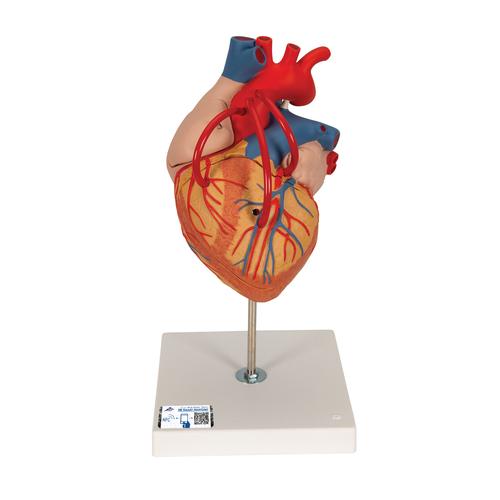 心脏搭桥的心脏模型，实物的 2倍，4部分 - 3B Smart Anatomy, 1000263 [G06], 心脏和循环系统模型
