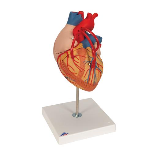 心脏搭桥的心脏模型，实物的 2倍，4部分 - 3B Smart Anatomy, 1000263 [G06], 心脏和循环系统模型