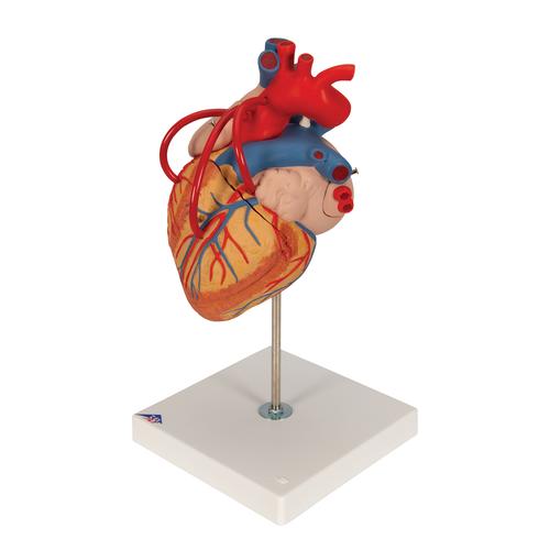 Coração com pontagem coronária, 2 vezes o tamanho natural, 4 partes, 1000263 [G06], Modelo de coração e circulação