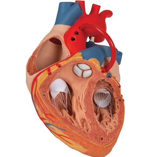 Cœur avec pontage, agrandi 2 fois, en 4 parties - 3B Smart Anatomy, 1000263 [G06], Modèles cœur et circulation