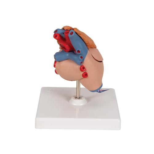 经典心脏与胸腺模型，3部分 - 3B Smart Anatomy, 1000265 [G08/1], 心脏和循环系统模型