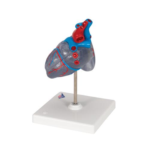 3B Scientific Anatomie-Modell – Menschliches Herz Mit Linksventrikulärer Hypertrophie (LVH), 2-teilig + Kostenlose 3B Smart Anatomy App