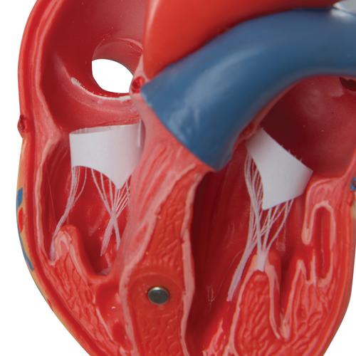 기본형 심장모형, 2-파트 Classic Human Heart Model, 2 part - 3B Smart Anatomy, 1017800 [G08], 심장 및 순환기 모형