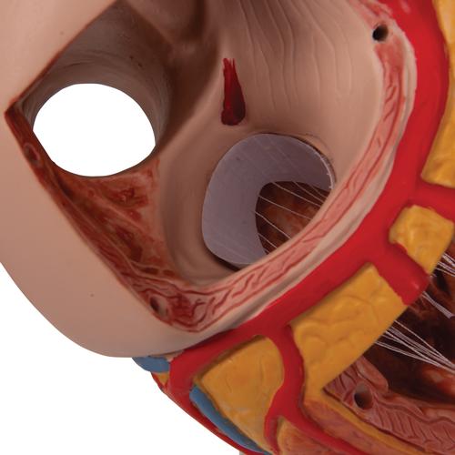 Модель сердца, 2-кратное увеличение, 4 части - 3B Smart Anatomy, 1000268 [G12], Модели сердца и сосудистой системы