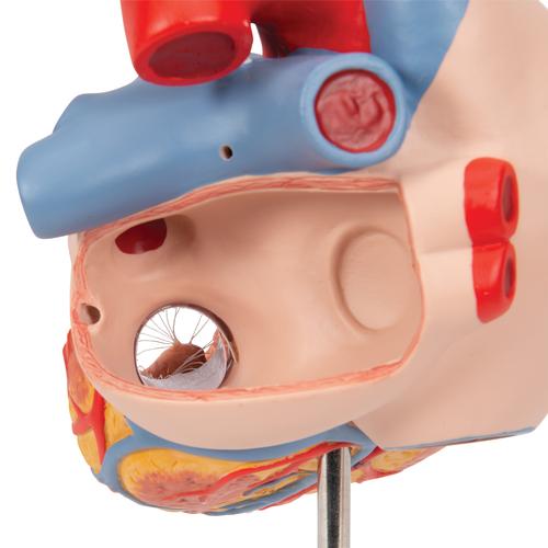 Cœur avec trachée et oesophage, agrandi 2 fois, en 5 parties - 3B Smart Anatomy, 1000269 [G13], Modèles cœur et circulation