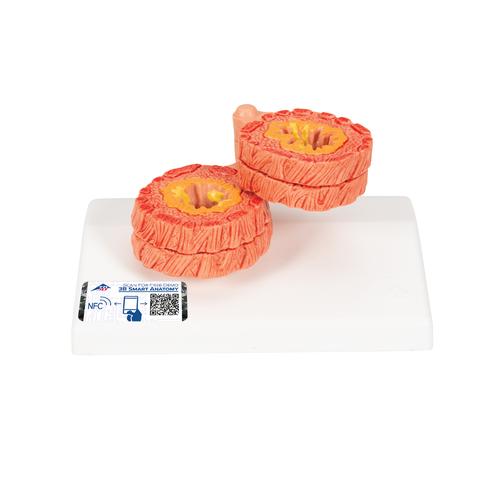 COPD Lungenmodell, 1012788 [G50/1], Lungenmodelle