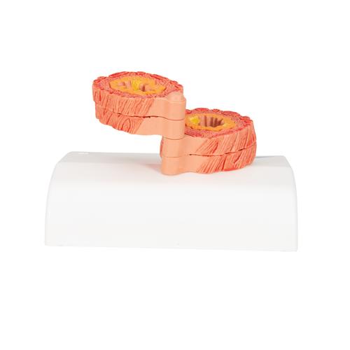 COPD Lungenmodell, 1012788 [G50/1], Lungenmodelle
