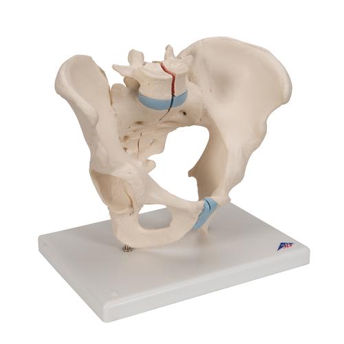 남성 골반모형, 3-파트 Pelvis male, 3-part - 3B Smart Anatomy, 1013026 [H21/1], 생식기 및 골반 모델