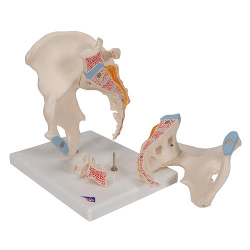 男性骨盆,3部分 - 3B Smart Anatomy, 1013026 [H21/1], 生殖和骨盆模型
