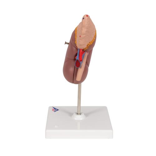 El riñón con glándula adrenal, en 2 piezas - 3B Smart Anatomy, 1014211 [K12], Modelos del Sistema Urinario