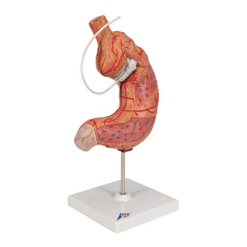 Human Stomach Model with Gastric Band, 2 part - 3B Smart Anatomy, 1012787 [K15/1], Digestive System Models