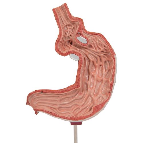 胃束带模型, 1012787 [K15/1], 消化系统