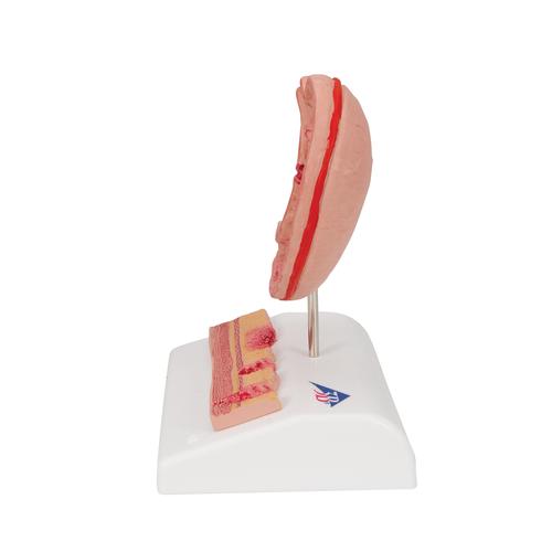 Human Stomach Section Model with Ulcers - 3B Smart Anatomy, 1000304 [K17], Digestive System Models