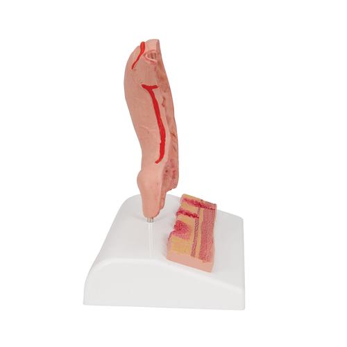 Human Stomach Section Model with Ulcers - 3B Smart Anatomy, 1000304 [K17], Digestive System Models