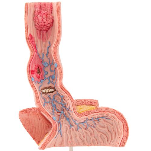 Affections de l'œsophage - 3B Smart Anatomy, 1000305 [K18], Modèles de systèmes digestifs