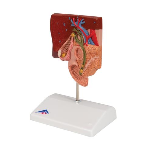 Модель желчного камня - 3B Smart Anatomy, 1000314 [K26], Модели пищеварительной системы человека
