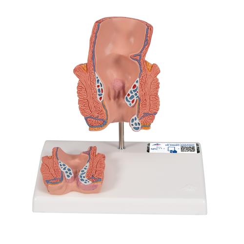 Модель геморроя - 3B Smart Anatomy, 1000315 [K27], Модели пищеварительной системы человека