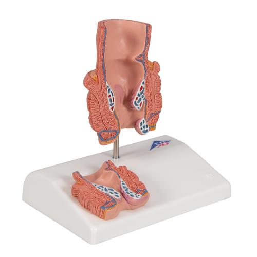 치질 모형
Hemorrhoid Model - 3B Smart Anatomy, 1000315 [K27], 소화기 모형