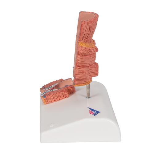 H&auml;morrhoidenmodell, 1000315 [K27], Verdauungssystem