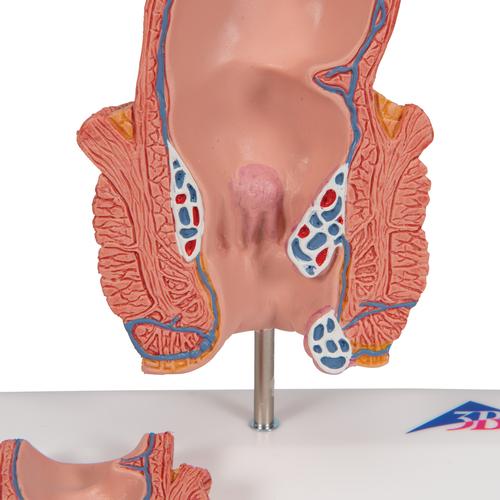 Modelo para a representação das hemorroidas, 1000315 [K27], Modelo de sistema digestivo