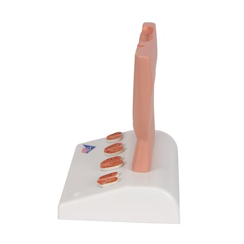 Modello di prostata, &frac12; grandezza naturale, 1000319 [K41], Modelli di Apparato Urinario