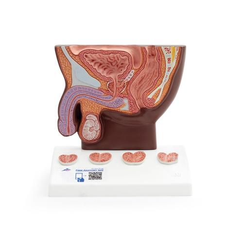 Modello di prostata, &frac12; grandezza naturale,&nbsp;pelle scura, 1024384 [K41D], Modelli di Apparato Urinario