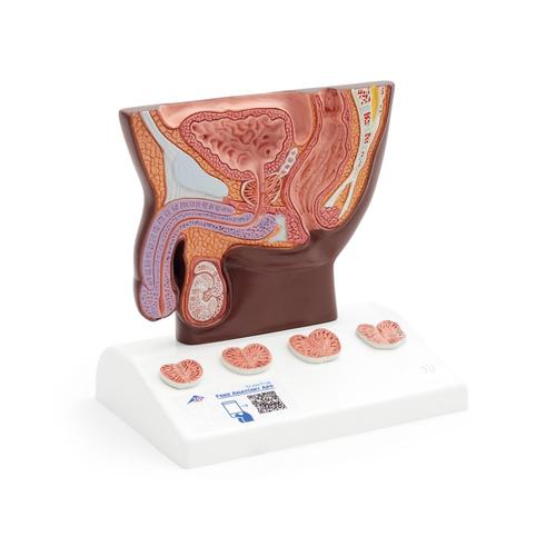 Modello di prostata, &frac12; grandezza naturale,&nbsp;pelle scura, 1024384 [K41D], Modelli di Apparato Urinario