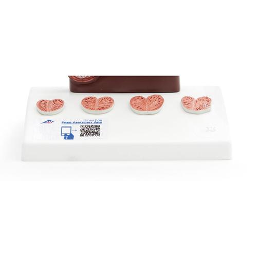 Modello di prostata, &frac12; grandezza naturale,&nbsp;pelle scura, 1024384 [K41D], Modelli di Apparato Urinario