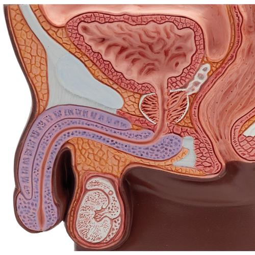 Modello di prostata, &frac12; grandezza naturale,&nbsp;pelle scura, 1024384 [K41D], Modelli di Apparato Urinario