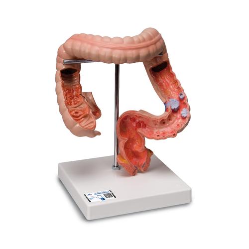 Модель толстой кишки - 3B Smart Anatomy, 1008496 [K55], Модели пищеварительной системы человека