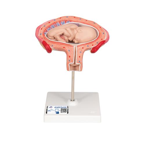 Fetus Model, 4th Month in Abdominal Position - 3B Smart Anatomy, 1018626 [L10/4], Pregnancy Models