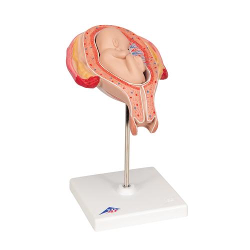 第五个月胎儿，臀位 - 3B Smart Anatomy, 1018630 [L10/5], 妊娠模型