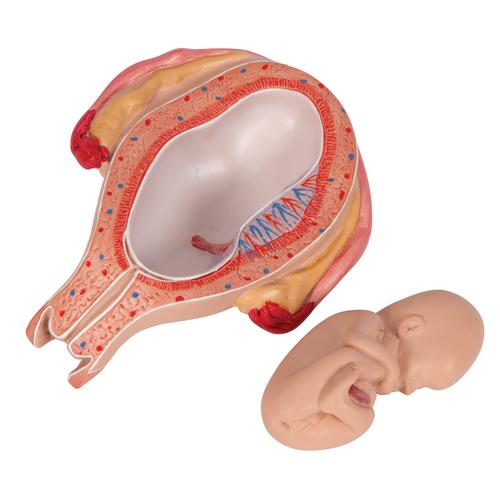 5개월의 태아 모형 (거꾸로 위치) 5th Month Fetus - Breech Position, 1018630 [L10/5], 인간 모형