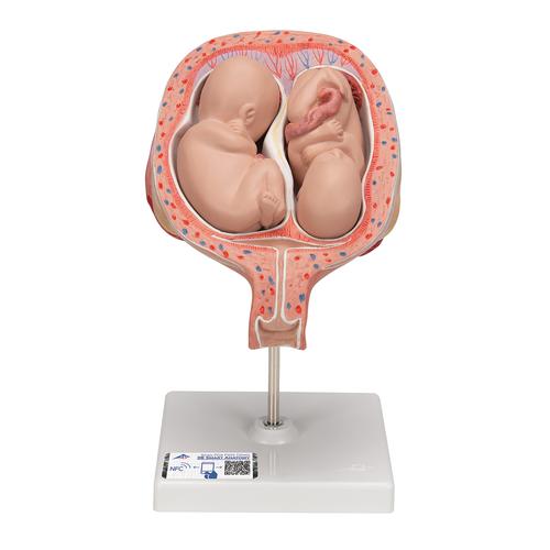 5. hónapos ikermagzatok, normál pozíció - 3B Smart Anatomy, 1000328 [L10/7], Terhességi modellek