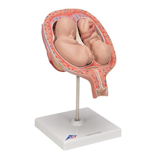 第五个月双胞，正常位置 - 3B Smart Anatomy, 1000328 [L10/7], 妊娠模型