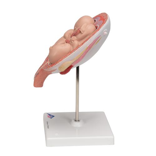 Zwillingsfeten Modell, 5. Monat, normale Position - 3B Smart Anatomy, 1000328 [L10/7], Schwangerschaft