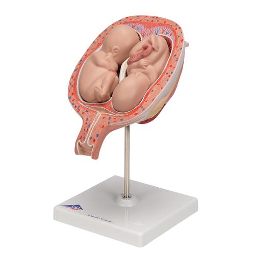 5개월 쌍둥이 태아 모형 5th Month Twin Fetuses - Normal Position - 3B Smart Anatomy, 1000328 [L10/7], 인간 모형