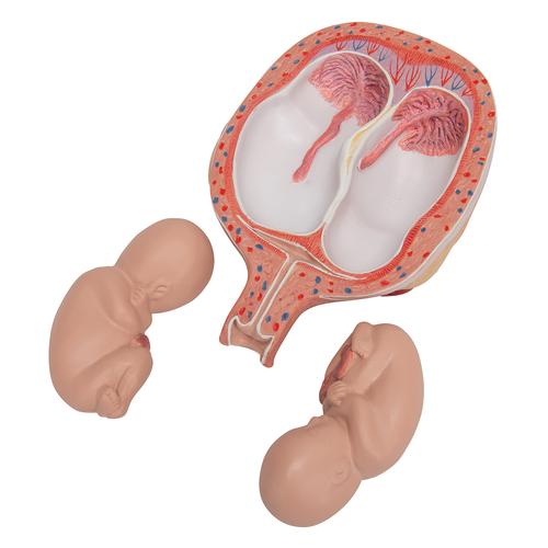 5개월 쌍둥이 태아 모형 5th Month Twin Fetuses - Normal Position - 3B Smart Anatomy, 1000328 [L10/7], 임신 모형