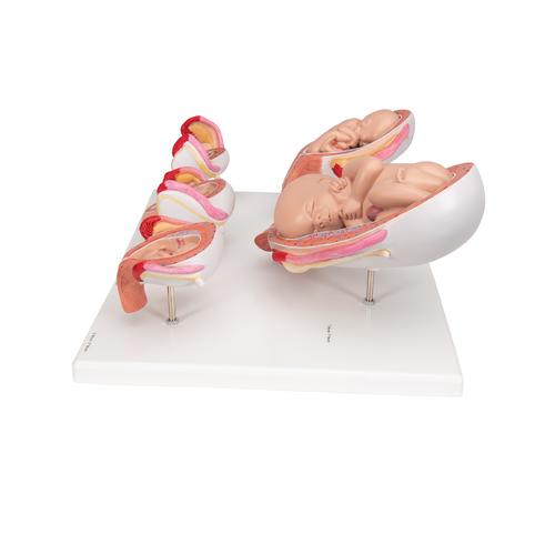 Набор из 5 моделей «Стадии беременности» 3B Scientific® - 3B Smart Anatomy, 1018633 [L11/9], Модели по оплодотворению и эмбриональному развитию человека