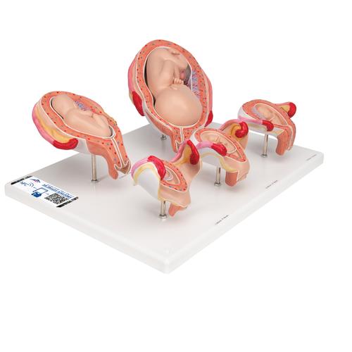 3B Scientific® 胎儿发育系列，5个模型 - 3B Smart Anatomy, 1018633 [L11/9], 妊娠模型