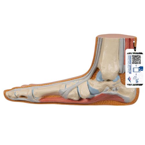 Flat Foot (Pes Planus) Model - 3B Smart Anatomy, 1000355 [M31], Joint Models