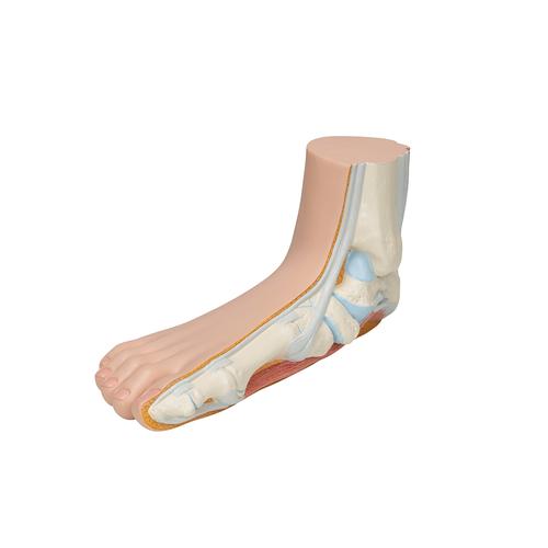 평발 Flat Foot (Pes Planus) Model - 3B Smart Anatomy, 1000355 [M31], 관절 모형