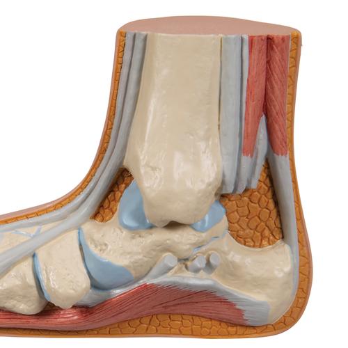 Модель плоской стопы - 3B Smart Anatomy, 1000355 [M31], Модели суставов, кисти и стопы человека