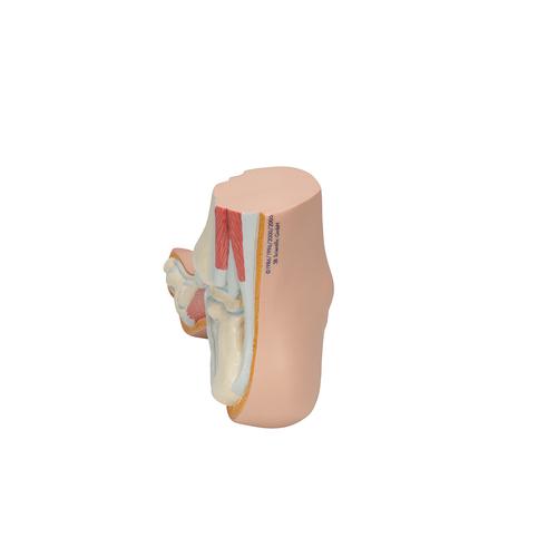 Pie Arqueado (Pes Cavus) - 3B Smart Anatomy, 1000356 [M32], Modelos de Articulaciones